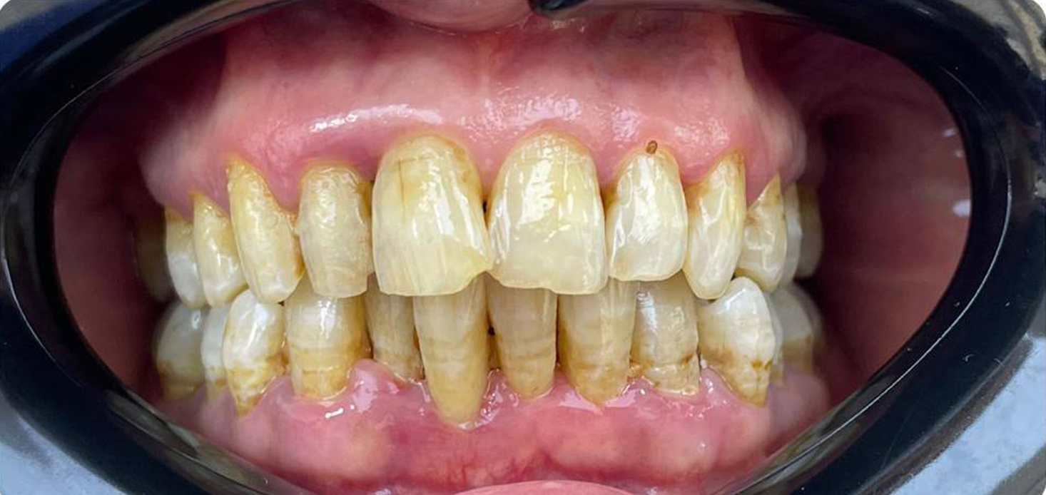 once Oral And Dental Treatments